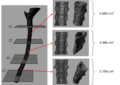 Volumetric spine.jpg